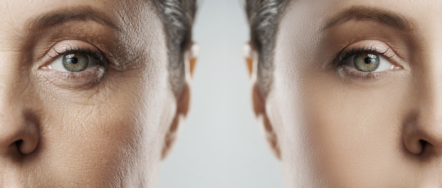 Occhi stanchi: quali possibili soluzioni?